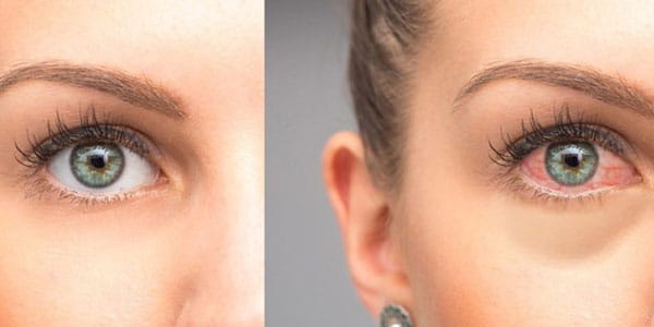Signs You Are Using the Wrong Eyelash Extension Glue